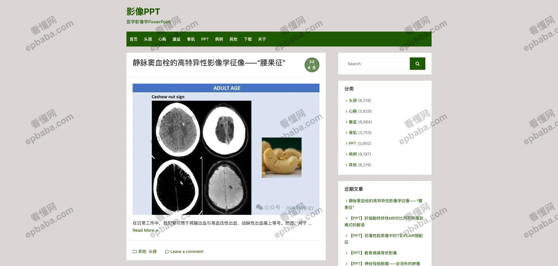 影像PPT：医学生、医疗从业者交流学习的医学博客站！