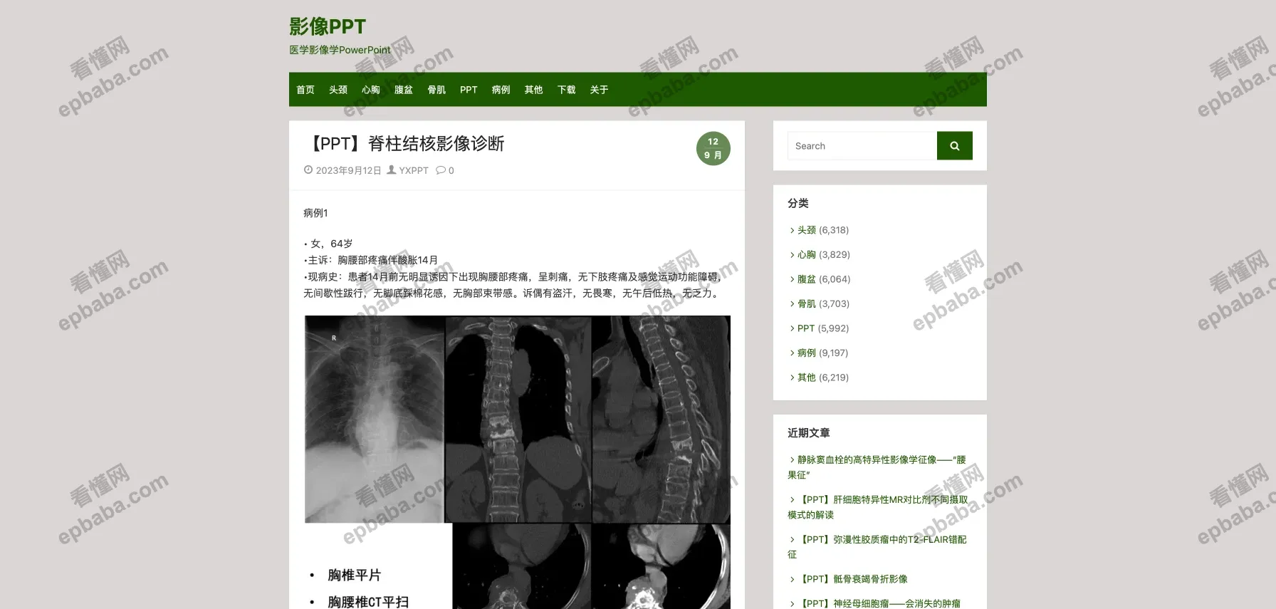 影像PPT：医学生、医疗从业者交流学习的医学博客站！